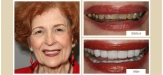 smile-gallery